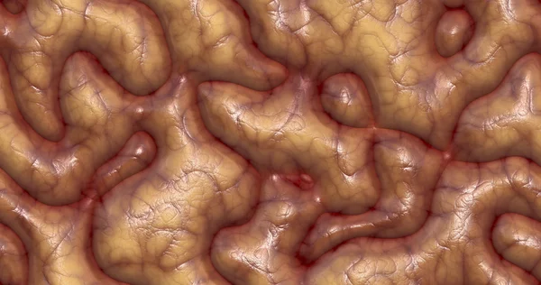 Серое Вещество Фото Серое Вещество Фото