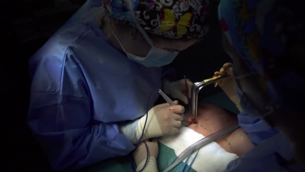 Cirurgião Cultura Realizando Mamoplastia Clínica — Vídeo de Stock