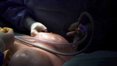 Ekin cerrahi ekibi kadınlara göğüs ameliyatı yapıyor.