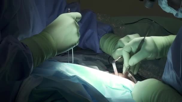在诊所做手术时 用医用牵引机给穿着长袍和乳胶手套的无名外科医生开刀 — 图库视频影像