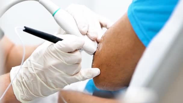 Unrecognizable Cropped Doctor Latex Gloves Inserting Needle Using Laser Probe — Stock Video