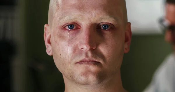 Crying cancer patient looking at camera — Stock Photo, Image