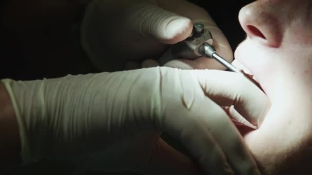 Il dentista tratta il dente — Video Stock