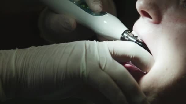 Tandläkaren behandlar tand — Stockvideo