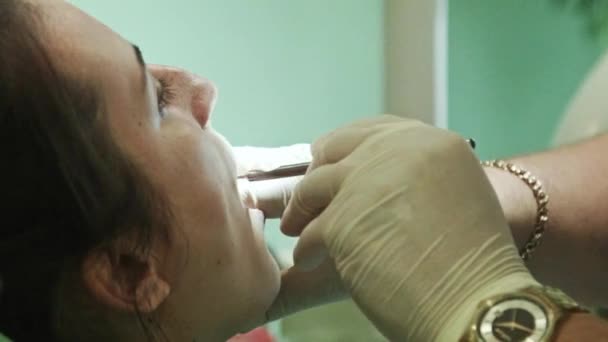 El dentista trata el diente — Vídeo de stock