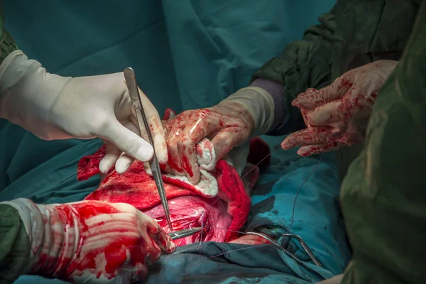 Cirugía en quirófano realizada por médicos — Foto de Stock