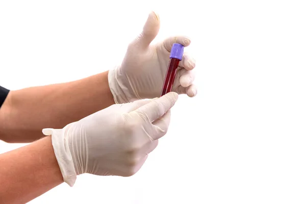 Human Hands Red Test Tube Isolated White Medical Concept — Stock Photo, Image