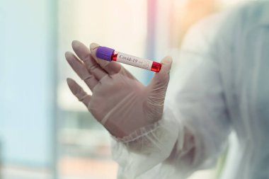 Coronavirus COVID-19 test ekipmanları için kan örneğiyle kadın elinde test tüpü..