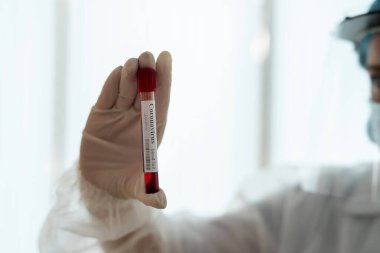 Laboratuvarda Coronavirus var mı diye hastaların kan örneklerini test eden bir tıp çalışanı.
