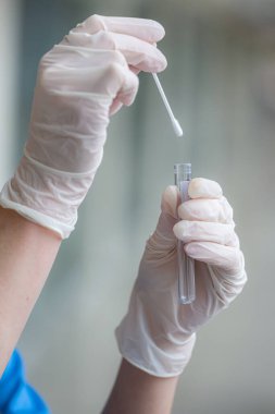 Kadın elinde COVID-19 teşhisi için tüp içinde solunum balgam örneği var. Sağlık hizmetleri