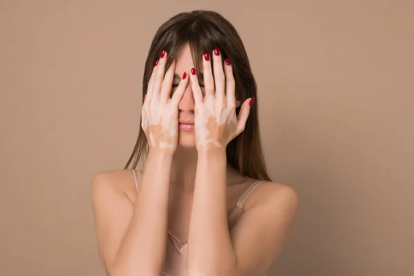 Una joven de pelo bastante largo con pigmentación de la piel cerrando la cara con las manos — Foto de Stock