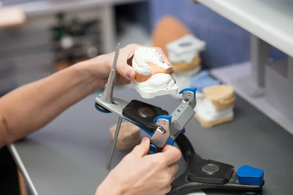 Prosthetist working with equipment at the dental clinic — Foto Stock
