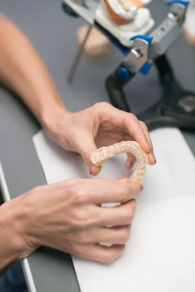 Close up picture of hands with dental prosthesis — Foto Stock