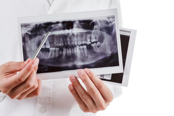 Стоматолог показує зображення щелепи — стокове фото