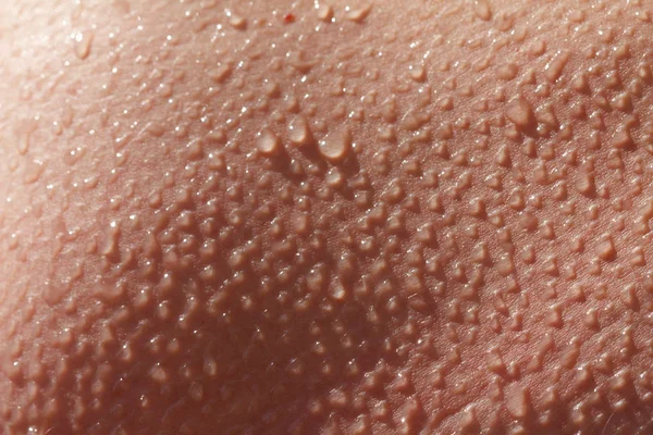 Human skin close up. — Stock Photo, Image