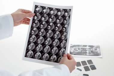 Panoramic dental X-Ray in hand. clipart