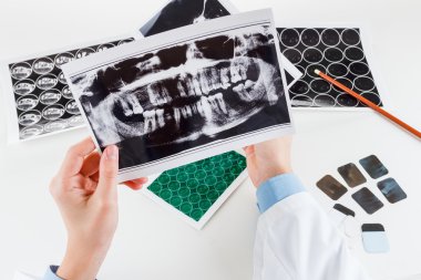 Panoramic dental X-Ray in hand. clipart