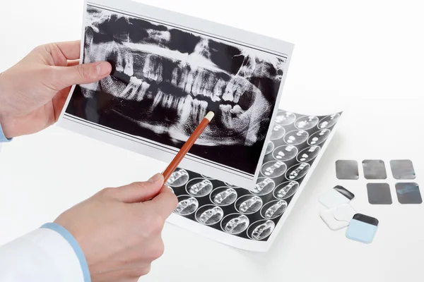 panaromik diş röntgenini el.