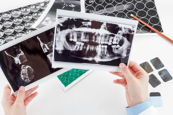 panaromik diş röntgenini el.