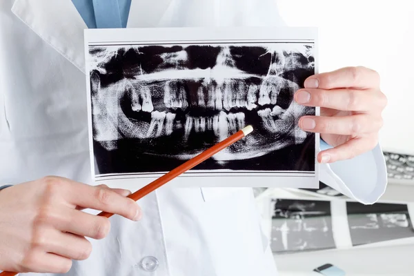 Radiografía dental panorámica en la mano . — Foto de Stock