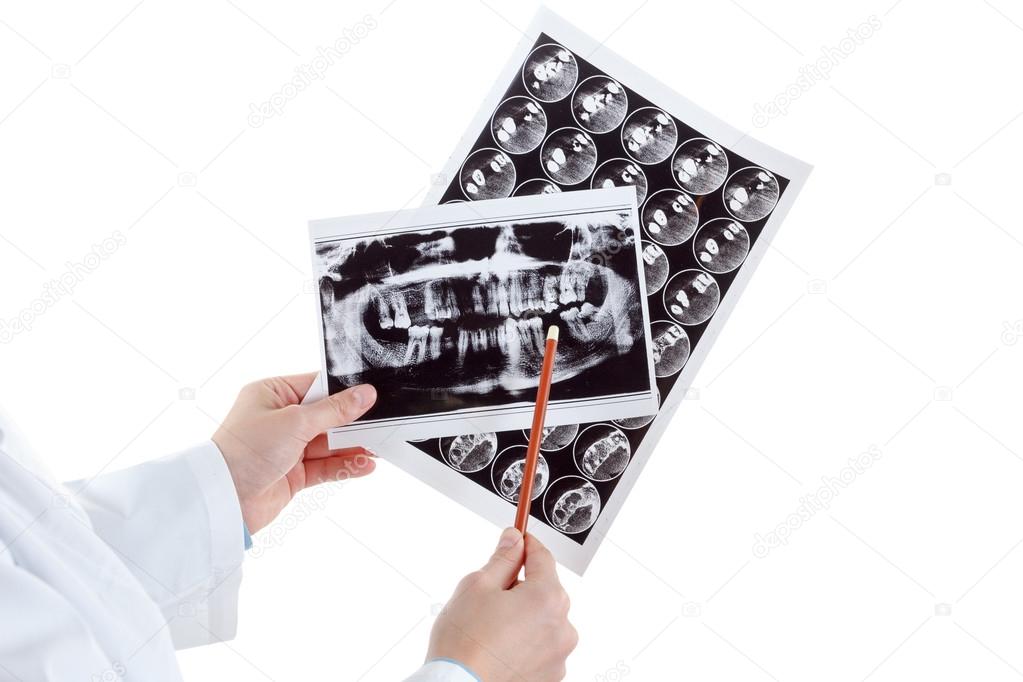 Radiografía dental panorámica en la mano. 2023