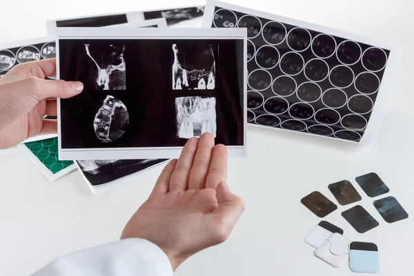 Panoramic dental X-Ray in hand. — Stock Photo, Image