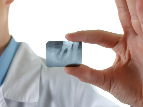 X-ışını periodontitis diş. 