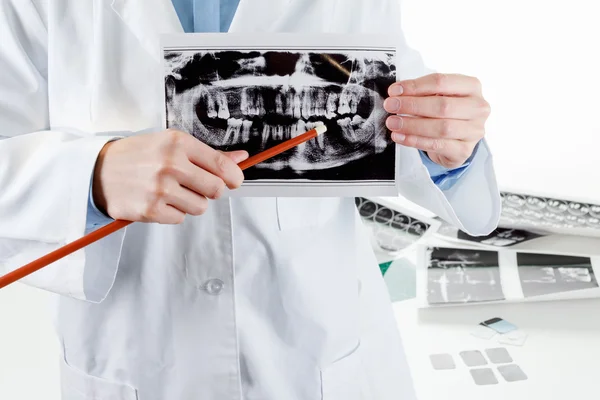 Панорамний зуб рентгенівський промінь в руці . — стокове фото