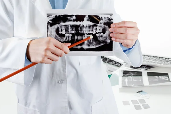 Radiografía dental panorámica en la mano . — Foto de Stock