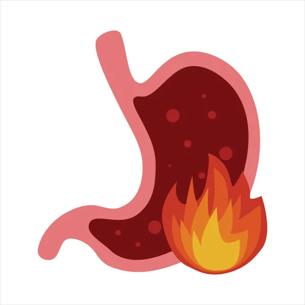 Gastritis Stomach Vector Flat Cartoon Illustration White Background — Stock Vector