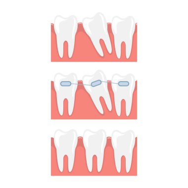 Beyaz arkaplanda izole edilmiş vektör tasarımı çizimi