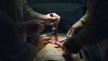 Laparoskopik cerrahi karın