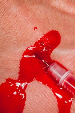 Tıbbi Subkutan Enjeksiyon kavramı