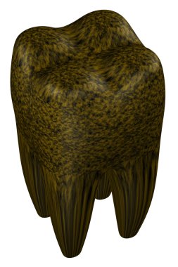 Çürümüş insan dişi. 3D render.