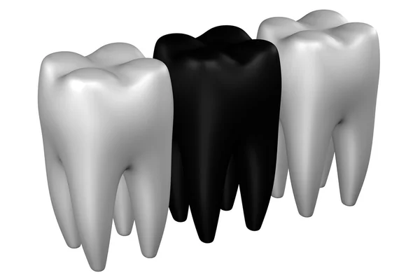 Dentes humanos. Renderização 3D . — Fotografia de Stock