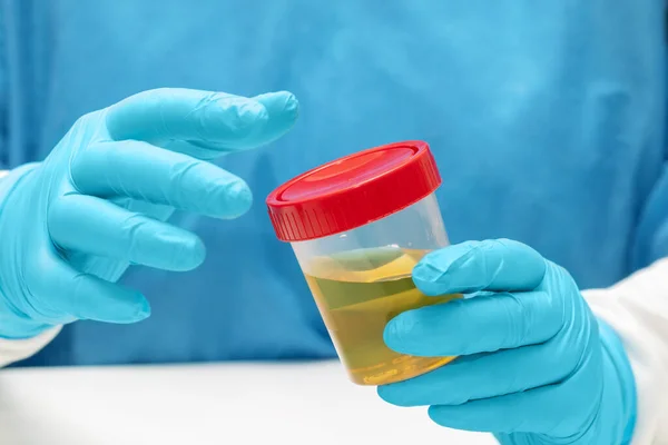 Doktor, laboratuvar asistanı idrar örneği içeren bir kap tutuyor.