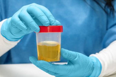  Doktor ya da laboratuvar teknisyeni analiz için idrar örneği içeren plastik bir kap tutuyor.