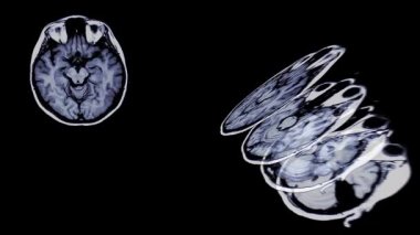 brain scan - brain scan slices animation in black background