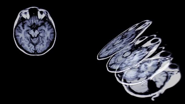 Brain Scan Brain Scan Slices Animation Black Background — Stock video