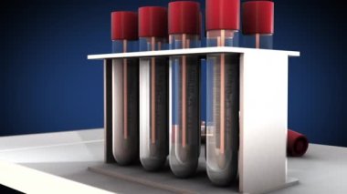 Coronavirus Kan Testi Test tüplerindeki kan örneklerini analiz ediyor