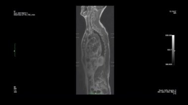 Siyah arkaplanda manyetik rezonans