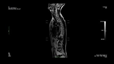 Siyah arkaplanda manyetik rezonans