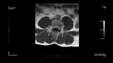Siyah arkaplanda manyetik rezonans