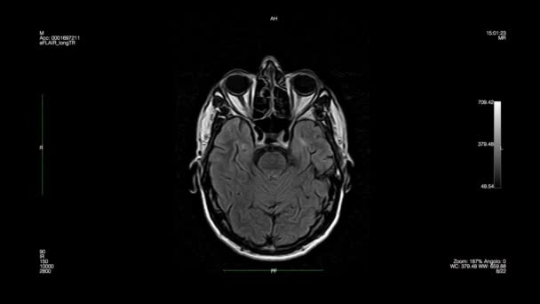 Magnetic Resonance Black Background — Stock Video