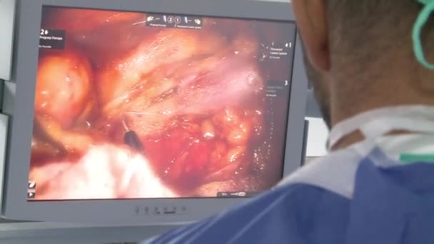 Monitor Operatie Arts Van Schouders Detail Chirurgie Kamer — Stockvideo