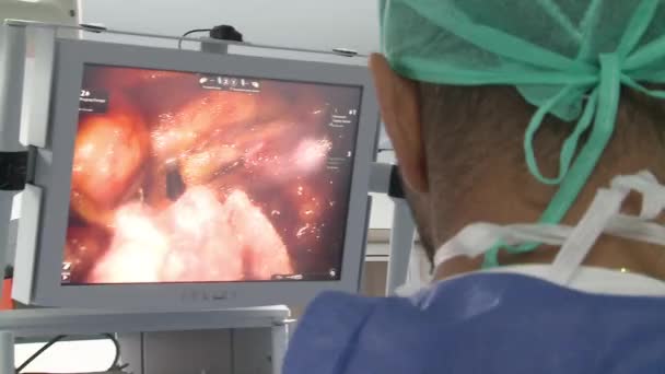 Operação Monitor Médico Ombros Sala Cirurgia — Vídeo de Stock