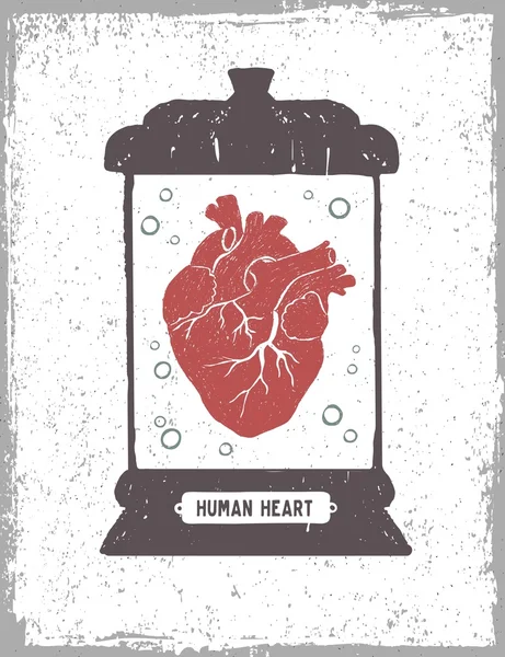 Serce człowieka w ilustracji wektorowych medycznych jar. — Wektor stockowy