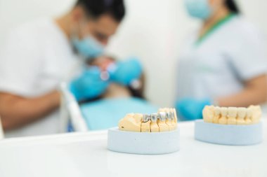 Dişçinin masasında sahte çene. diş sağlığı