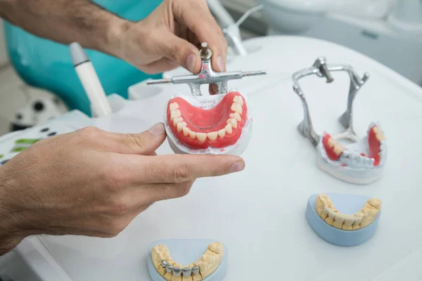 Dişçinin elinde sahte bir çene var.