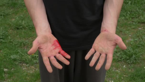 Man Showing Two Injured Hands Blood — Stock Video